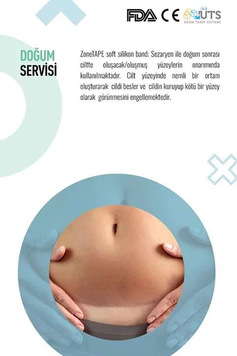 ZoneTAPE Soft Silikon Bant -kırışıklık-estetik-dikiş-skar-keloid-sezaryen-karın/kol/bacak Germe-ben Aldırma 6