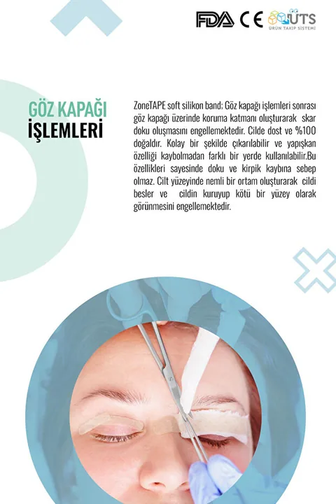 ZoneTAPE Soft Silikon Bant -kırışıklık-estetik-dikiş-skar-keloid-sezaryen-karın/kol/bacak Germe-ben Aldırma 7